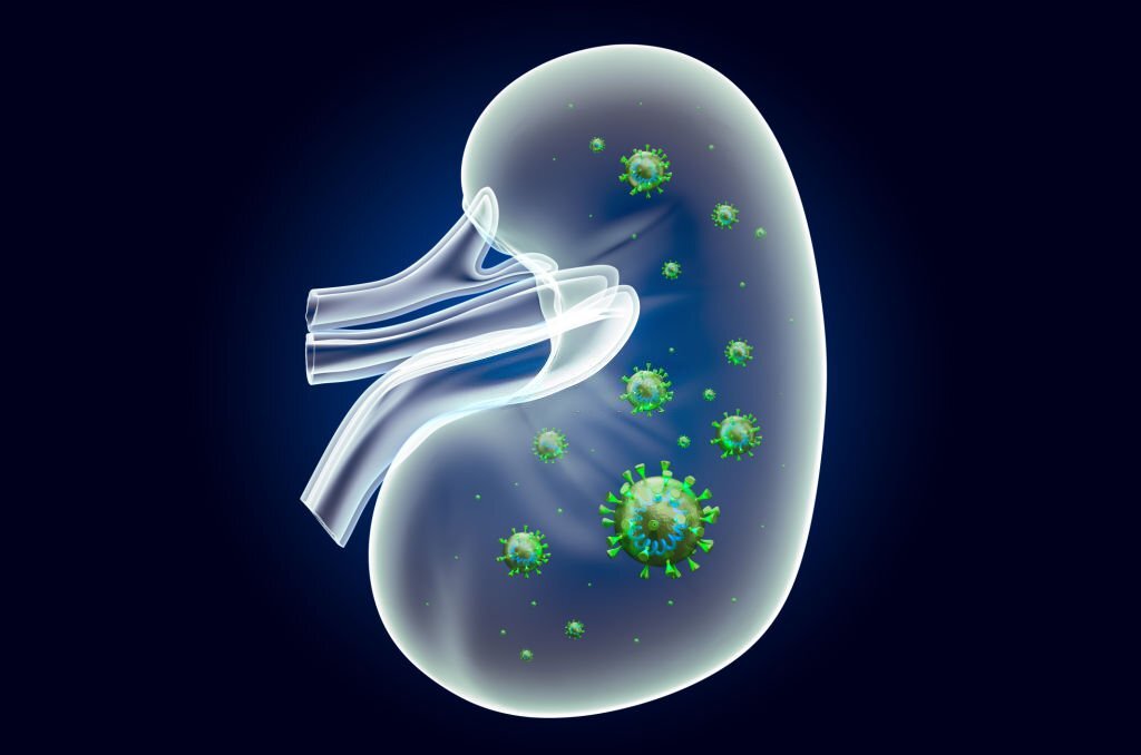 The Agony Within: Understanding the Pain Caused by Kidney Stones